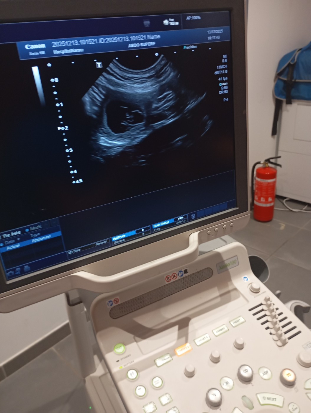 Les bébés chocolat de Téquila et Sancerre sont en route !